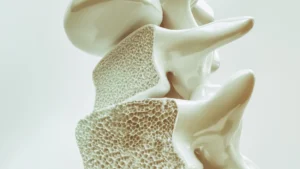 Ilustración médica en 3D de una vértebra humana que muestra la estructura interna del hueso con apariencia porosa, representando la osteoporosis o pérdida de densidad ósea.
